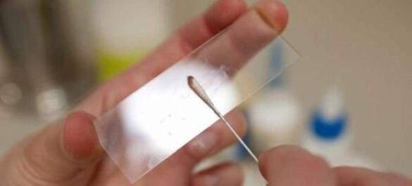 Féregpeték kikaparása